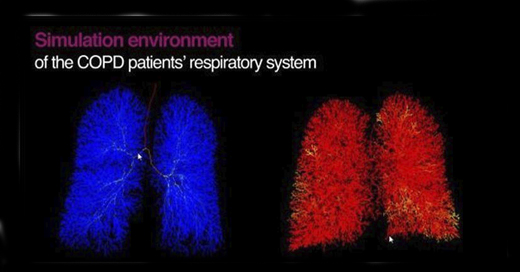 synergycopd eurecat
